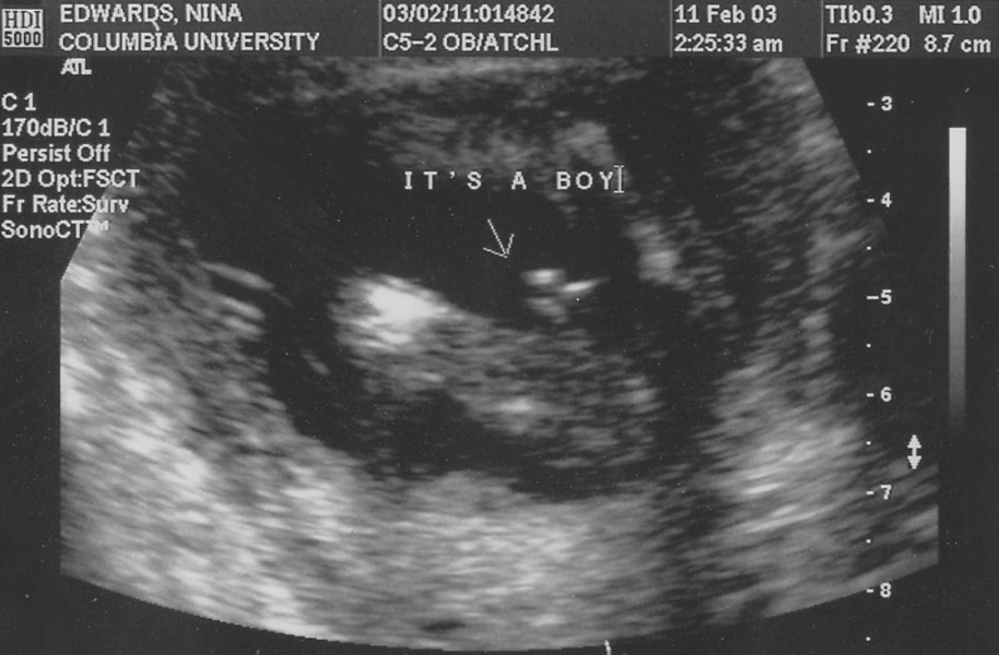 p2030001 Its A Boy Ultrasound